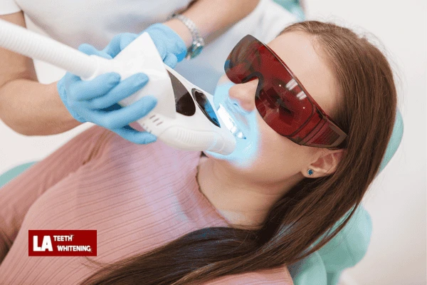 Do You Get Instant Hollywood-White Teeth After One Session Horsham